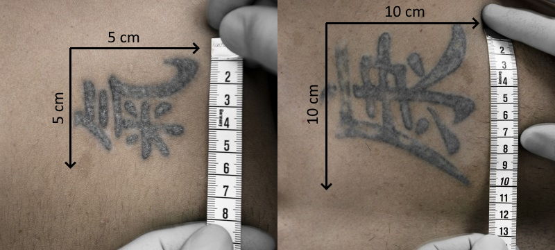 Grösse des Tattoos für die Tattooentfernung in Zürich ausmessen – Länge und Breite in Zentimetern